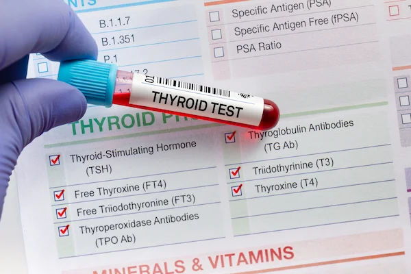 thyroid test